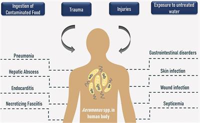 Aeromonas and Human Health Disorders: Clinical Approaches